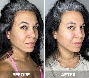 South Beach Skin Lab customer-Cynthia K.
