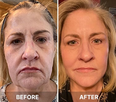 South Beach Skin Lab customer -Sondra W.